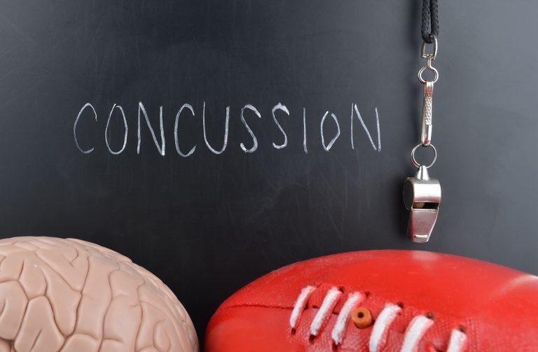 concussions
