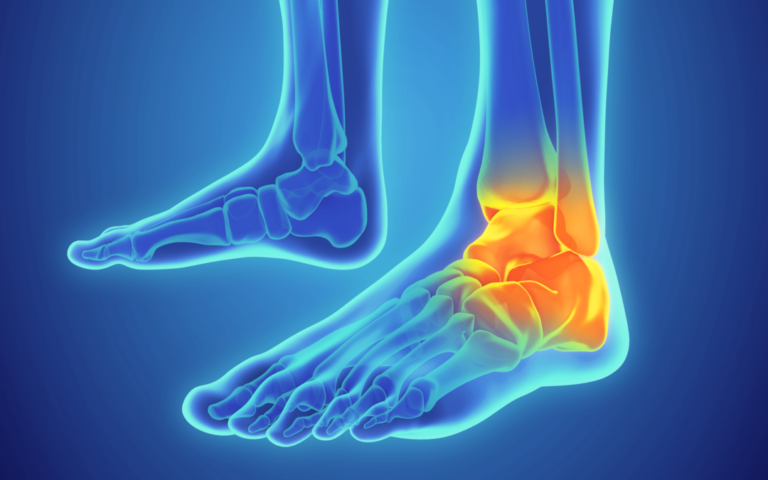Ankle Strength