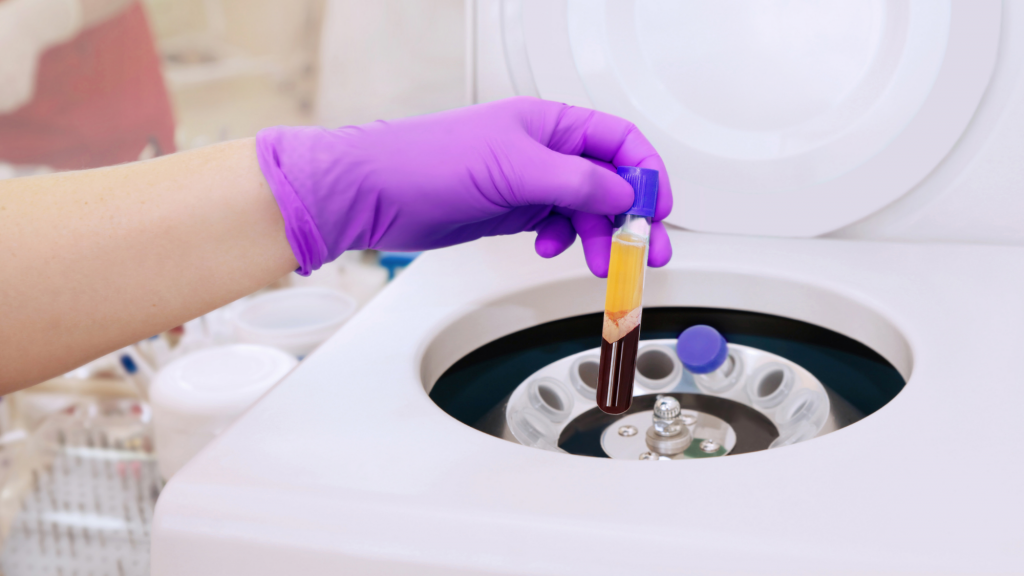 platelet rich plasma being used to help encourage healing for patient at kaizo health in washington, dc.