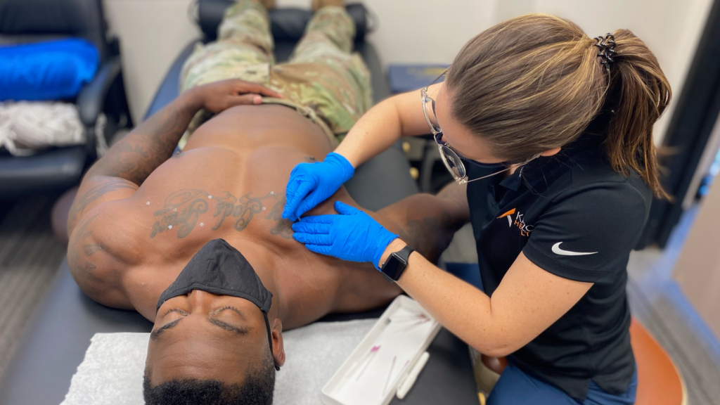 man getting dry needling at kaizo chiropractor office in his right chest muscle