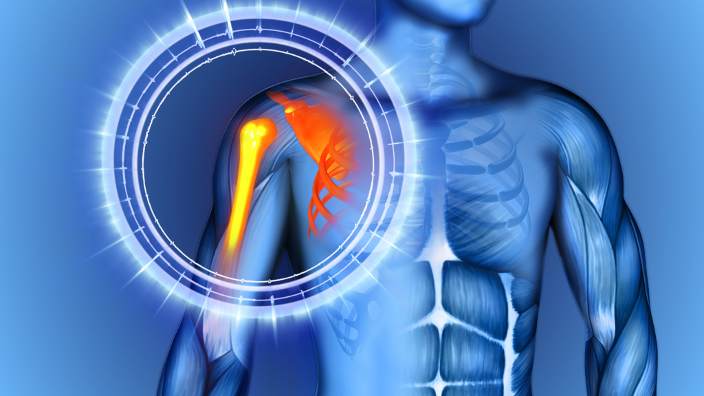 shoulder labral tear