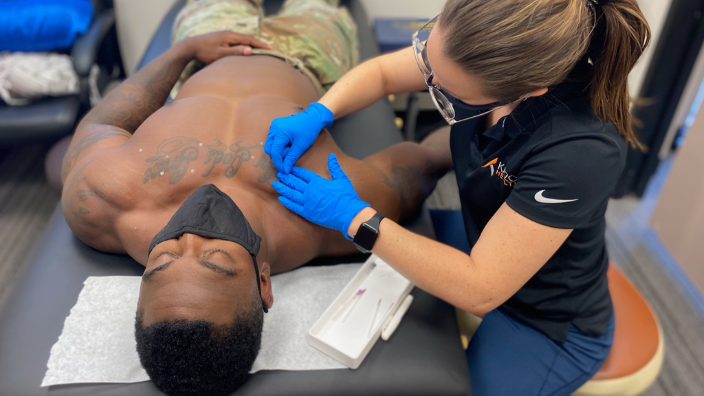 chiropractor doing dry needling on patients right shoulder