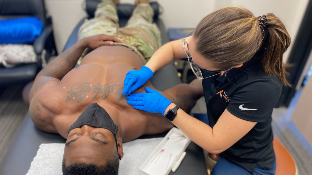 dry needling